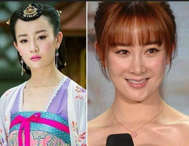 坦然面對整容，女明星的美麗新篇章之旅