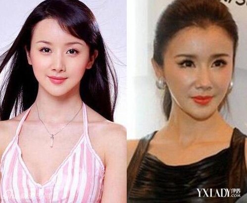 探秘明星整容的秘密，神秘美容小店的魅力所在！